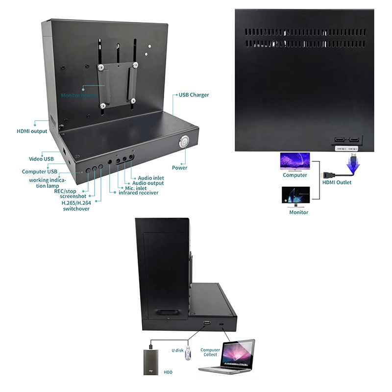 dental surgery microscope  03