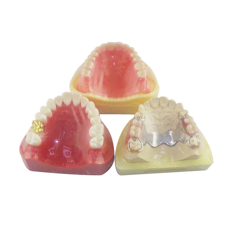 UM-S13 Prosthodontic Model